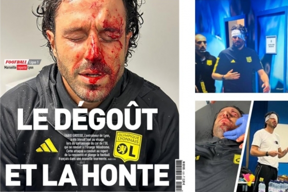 L&#039;Equipe na naslovnici objavio fotografiju krvavog lica trenera Lyona