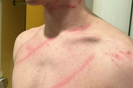 1-B HVL: Siscia u derbiju pobijedila Jadran Kostrenu u utakmici s 44 pogodaka